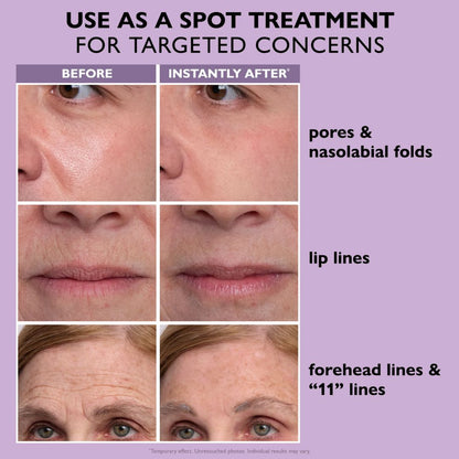 Instant Face Provisional Eye Tightener