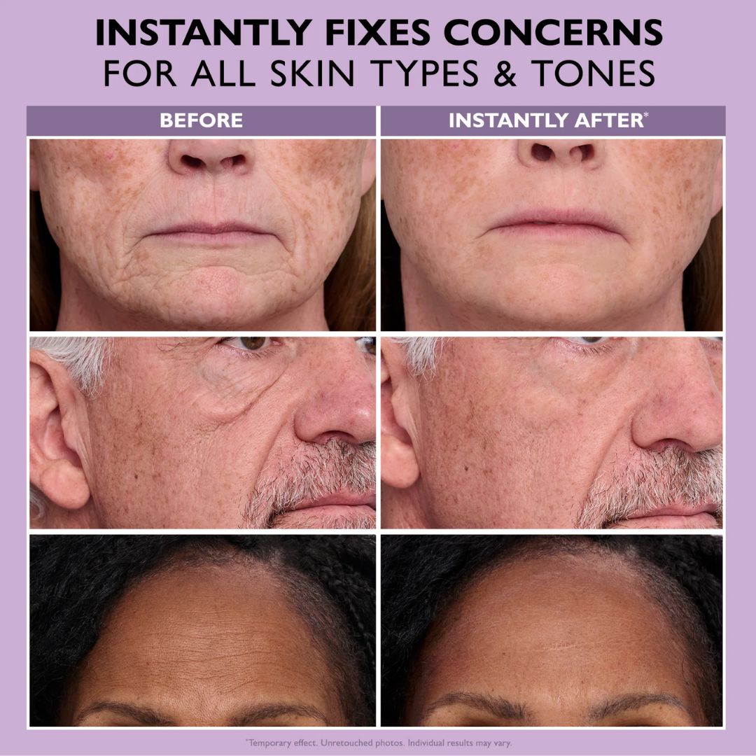 Instant Face Provisional Eye Tightener